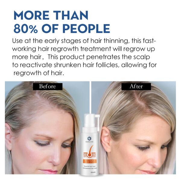 HAIRCUBE Hair Growth Spray Essential Oil Liquid Anti Hair Loss Essence Serum for Hair Growth Oil Natural Hair Care Products
