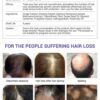Hair Care Hair Growth Essential Oils Essence Original Authentic 100% Hair Loss Liquid Health Care Beauty Dense Hair Growth Serum