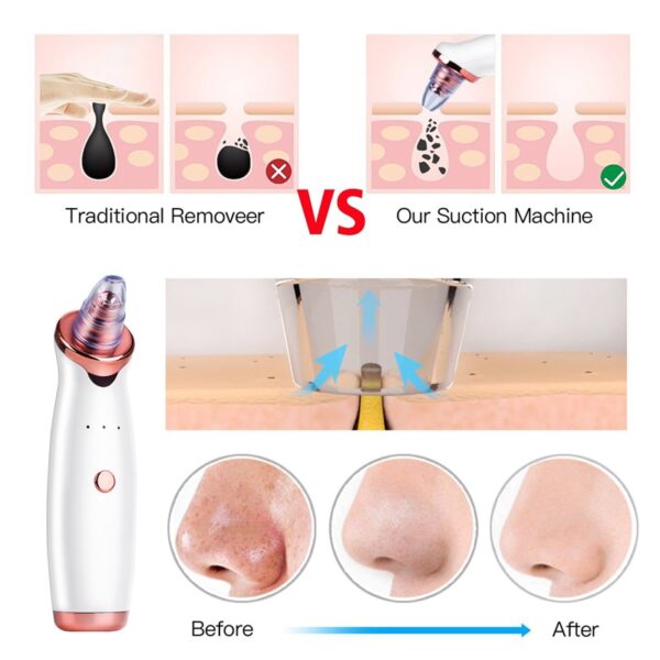 Microdermabrasion Blackhead Remover Vacuum Suction Face Pimple Acne Comedone Extractor Facial Pores Cleaner Skin Care Tools 38