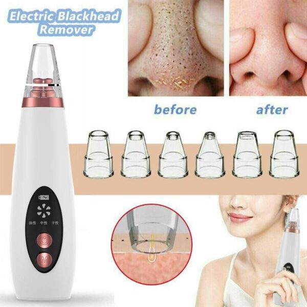 USB Blackhead Black Dot Remover Face Pore Vacuum Skin Care Acne Pore Cleaner Pimple Removal Vacuum Suction Tools